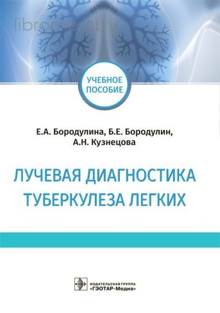 Лучевая диагностика туберкулеза легких. Учебное пособие. Бородулина Е. А.-ГЭОТАР-Медиа, 2021
