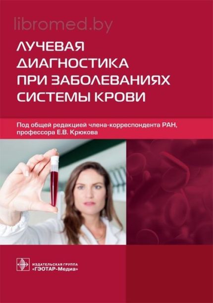 Лучевая диагностика при заболеваниях системы крови. Под ред. Е. В. Крюкова.-ГЭОТАР-Медиа, 2021