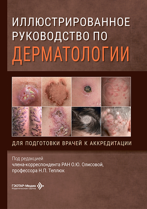 Иллюстрированное руководство по дерматологии. Для подготовки врачей к аккредитации 1