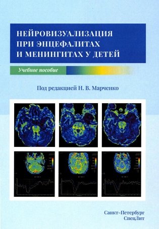 Нейровизуализация при энцефалитах и менингитах у детей. Учебное пособие.  Марченко Н. В.-СпецЛит, 2023