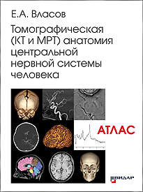 Томографическая (КТ и МРТ) анатомия центральной нервной системы человека. Атлас. Власов Е. А.-Видар-М, 2020