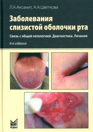 Заболевания слизистой оболочки рта. Связь с общей патологией. Диагностика. Лечение. 6-е изд. Аксамит Л. А.-Медпресс-информ, 2025