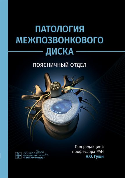 Патология межпозвонкового диска. Поясничный отдел. Под ред. А. О. Гущи.-ГЭОТАР-Медиа, 2025