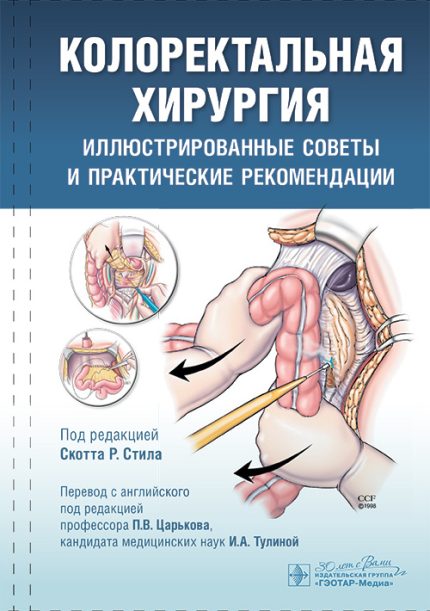 Колоректальная хирургия. Иллюстрированные советы и практические рекомендации. Под ред. С. Р. Стила.-ГЭОТАР-Медиа, 2025