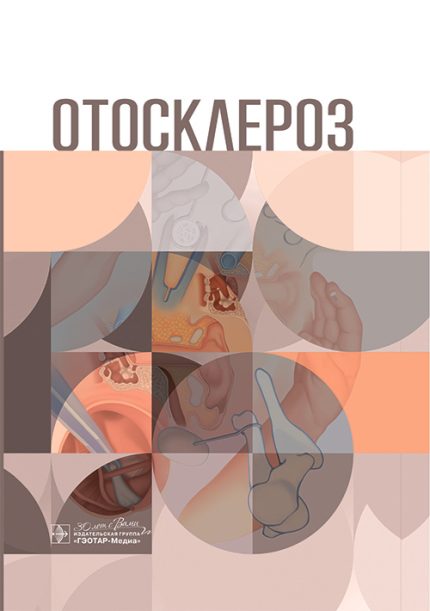Отосклероз. Крюков А. И.-ГЭОТАР-Медиа, 2025