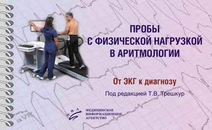 Пробы с физической нагрузкой в аритмологии. От ЭКГ к диагнозу. Трешкур Т. В.-МИА, 2025