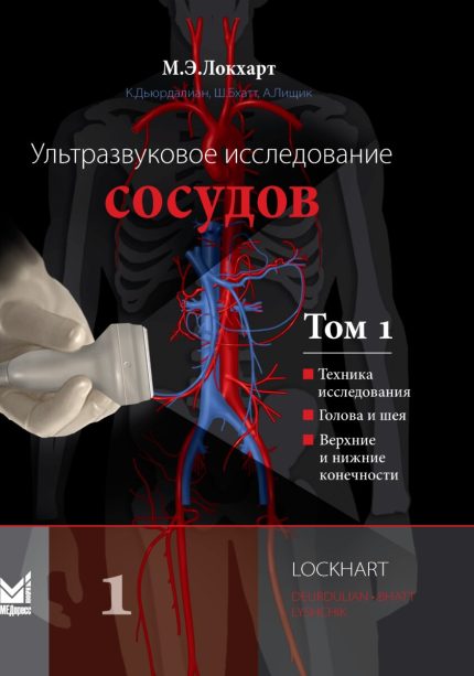 Ультразвуковое исследование сосудов. В 2-х т. Т. 1. Локхарт М. Э.-МЕДпресс-информ, 2025