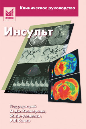 Инсульт. Клиническое руководство. Под ред. М. Г. Хеннерици.-МЕДпресс-информ, 2008