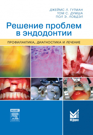 Решение проблем в эндодонтии. 2-е изд. Гутман Дж.-МЕДпресс-информ, 2014
