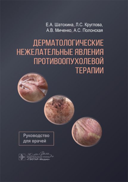 Дерматологические нежелательные явления противоопухолевой терапии. Руководство для врачей. Шатохина Е. А.-ГЭОТАР-Медиа, 2025