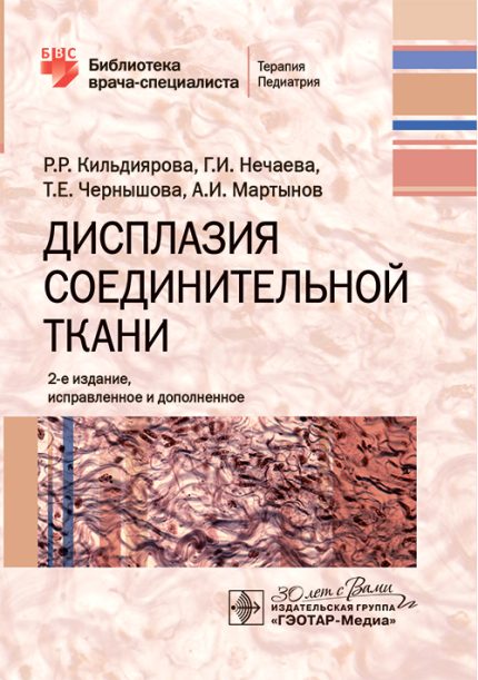 Дисплазия соединительной ткани. 2-е изд. Кильдиярова Р. Р.-ГЭОТАР-Медиа, 2025