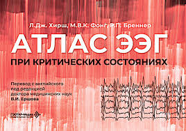 Атлас ЭЭГ при критических состояниях. Хирш Л. Дж.-ГЭОТАР-Медиа, 2026