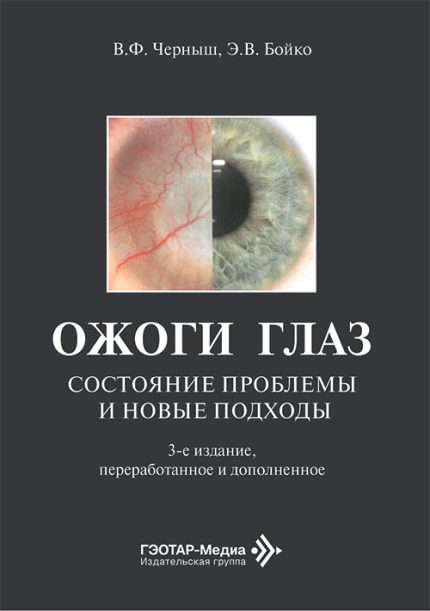 Ожоги глаз. Состояние проблемы и новые подходы. 3-е изд. Черныш В. Ф.-ГЭОТАР-Медиа, 2026