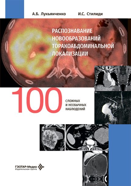 Распознавание новообразований торако-абдоминальной локализации. 100 сложных и необычных наблюдений. Лукьянченко А. Б.-ГЭОТАР-Медиа, 2026
