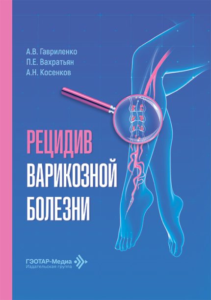 Рецидив варикозной болезни. Гавриленко А. В.-ГЭОТАР-Медиа, 2026