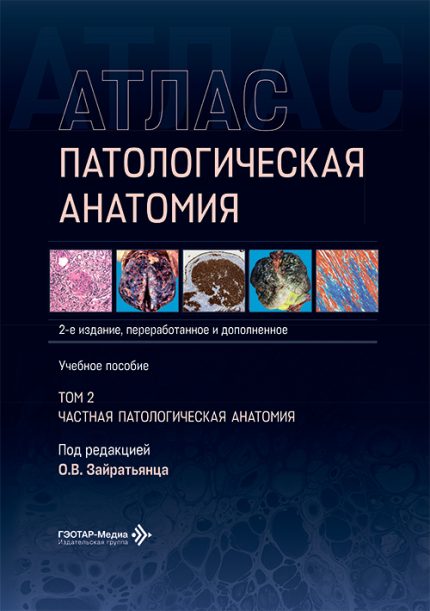 Патологическая анатомия. Атлас. Учебное пособие. В 2-х т. Т. 2. Частная патологическая анатомия. 2-е изд. Под ред. О. В. Зайратьянца.-ГЭОТАР-Медиа, 2026