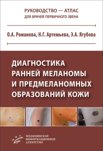 Диагностика ранней меланомы и предмеланомных образований кожи.  Руководство-атлас для врачей первичного звена. Романова О. А.-МИА, 2025