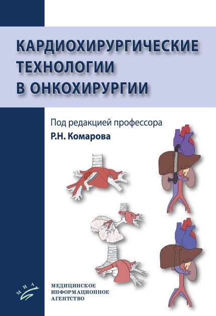 Кардиохирургические технологии в онкохирургии. Под ред. Р. Н. Комарова.-МИА, 2025
