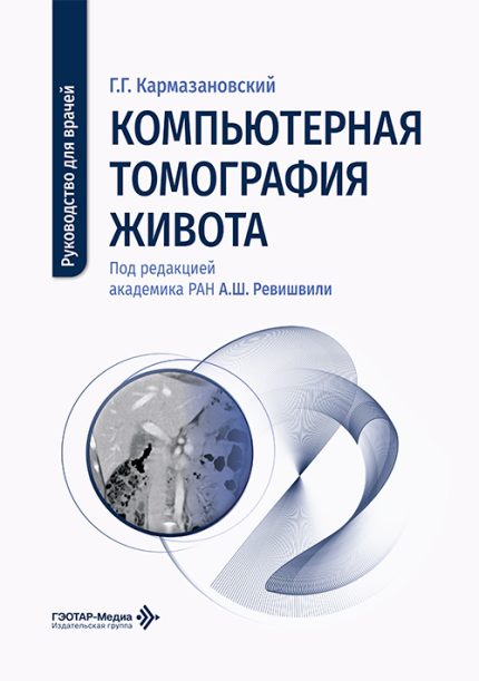 Компьютерная томография живота. Руководство для врачей. Кармазановский Г. Г.-ГЭОТАР-Медиа, 2026.