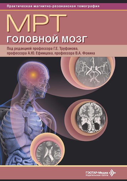 МРТ. Головной мозг. Руководство для врачей. Под ред. Г. Е. Труфанова.-ГЭОТАР-Медиа, 2026