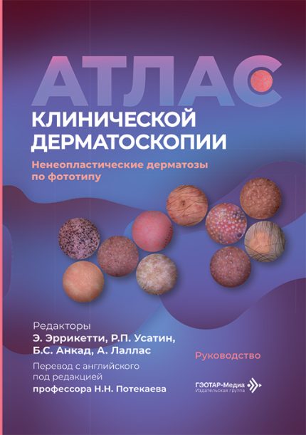 Атлас клинической дерматоскопии. Ненеопластические дерматозы по фототипу. Руководство. Под ред. Э. Эррикетти.-ГЭОТАР-Медиа, 2026