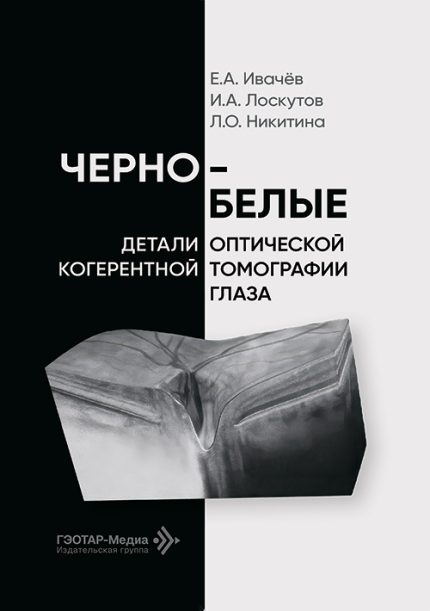 Черно-белые детали оптической когерентной томографии глаза. Ивачев Е. А.-ГЭОТАР-Медиа, 2026