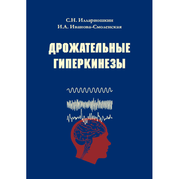 Дрожательные гиперкинезы