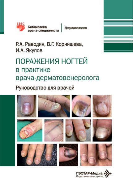 Поражения ногтей в практике врача-дерматовенеролога. Руководство для врачей. Раводин Р. А.-ГЭОТАР-Медиа, 2026