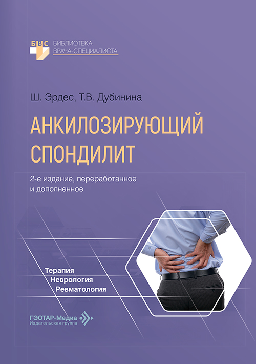 анкилозирующий спондилит