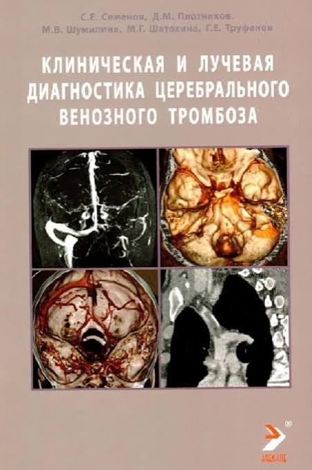 Клиническая и лучевая диагностика церберального венозного тромбоза