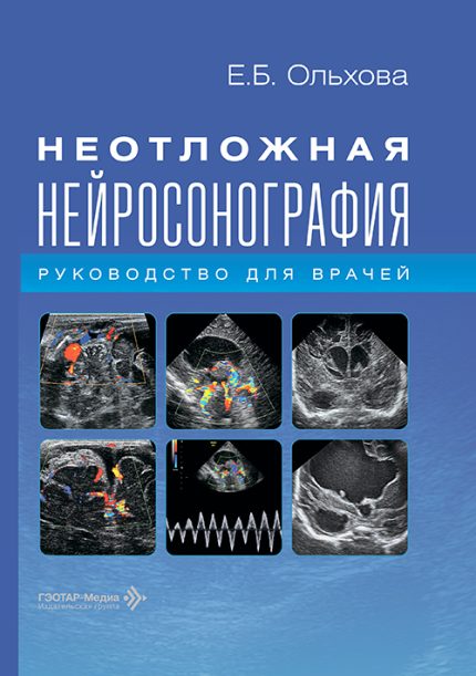 Неотложная нейросонография. Руководство для врачей. Ольхова Е. Б.-ГЭОТАР-Медиа, 2027