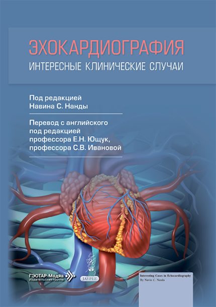 Эхокардиография. Интересные клинические случаи. Под ред. Н. С. Нанды.-ГЭОТАР-Медиа, 2026